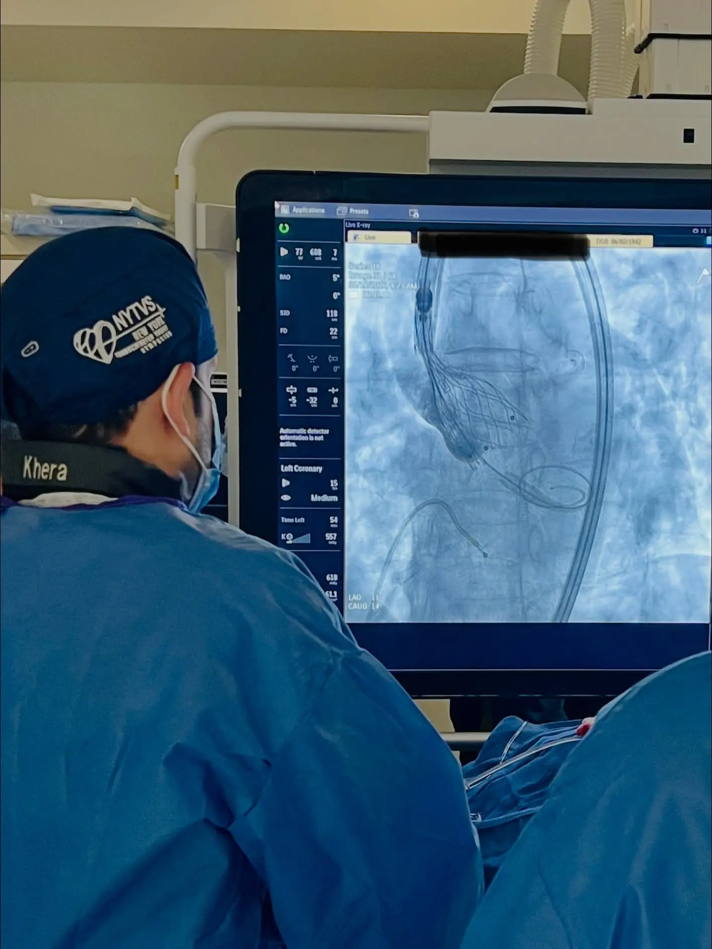 Mount Sinai Hospital TAVI 2