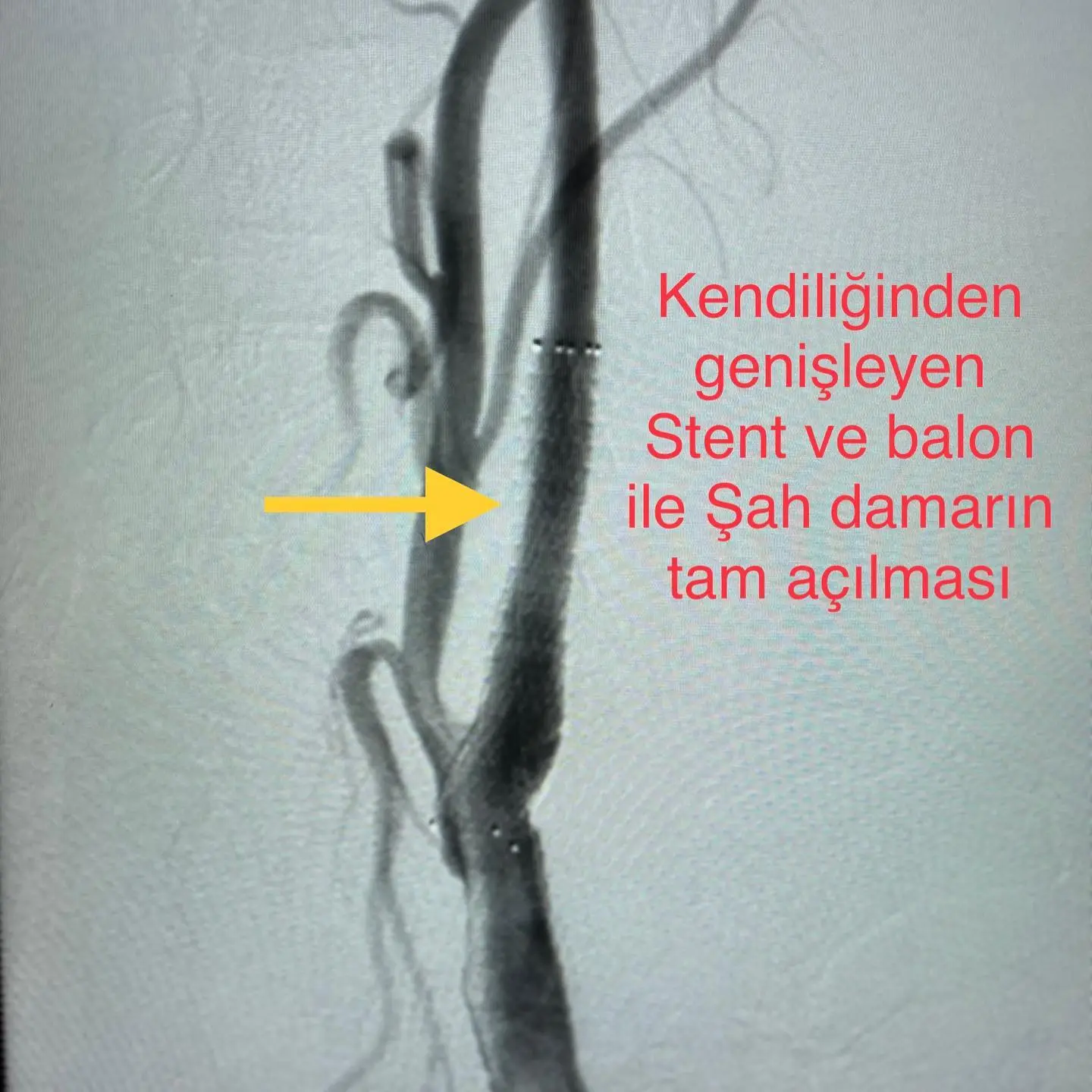 Prof. Dr. Klaus D. Mathias 4